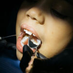 Emergency Dentist in Lake Wales, FL: Fast, Reliable Dental Care When You Need It Most