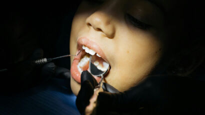 Emergency Dentist in Lake Wales, FL: Fast, Reliable Dental Care When You Need It Most