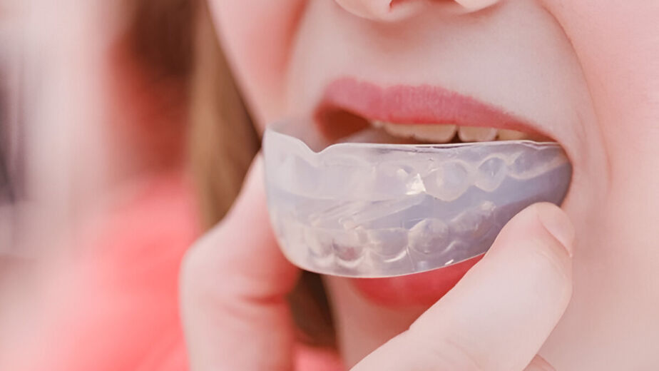 The Importance of Mouthguards in Sports