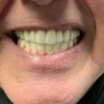 Lake Wales Dental Group