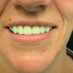 Lake Wales Dental Group