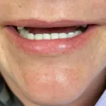 Lake Wales Dental Group