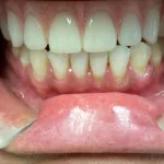 Lake Wales Dental Group