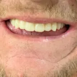 Lake Wales Dental Group