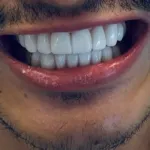 Lake Wales Dental Group