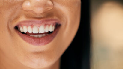 Lake Wales Dentistry: The Ultimate 2026 Guide to Choosing the Best Dentist in Lake Wales, FL